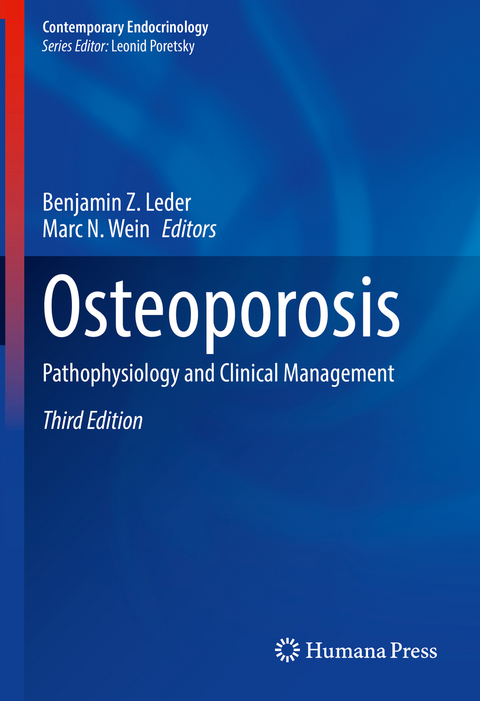 Osteoporosis - 