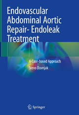 Endovascular Abdominal Aortic Repair- Endoleak Treatment - Stevo Duvnjak