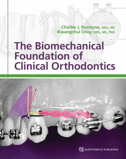 The Biomechanical Foundation of Clinical Orthodontics - Charles J. Burstone, Kwangchul Choy