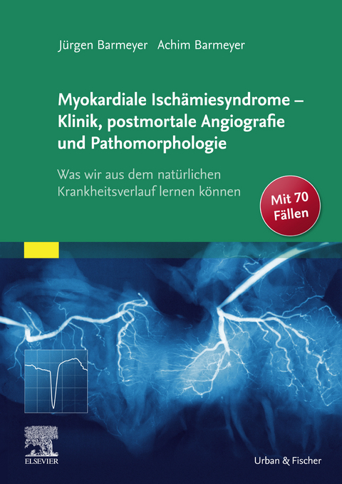 Die myokardialen Ischämiesyndrome - Klinik und postmortale Pathomorphologie -  Jürgen Barmeyer,  Achim Barmeyer
