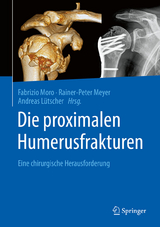 Die proximalen Humerusfrakturen - 