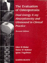 Evaluation Of Osteoporosis - Blake, Glen M; Wahner, Heinz W; Fogelman, Ignac