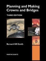 Planning and Making Crowns and Bridges - Smith, Bernard Gn