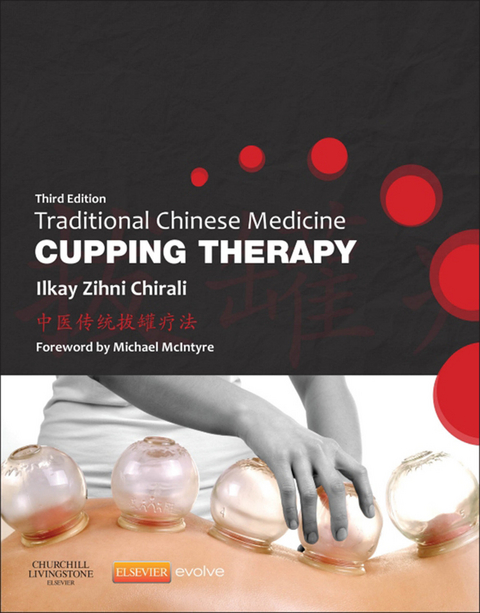 Traditional Chinese Medicine Cupping Therapy - E-Book -  Ilkay Z. Chirali