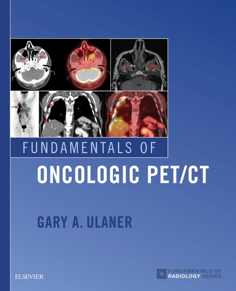 Fundamentals of Oncologic PET/CT -  Gary A. Ulaner