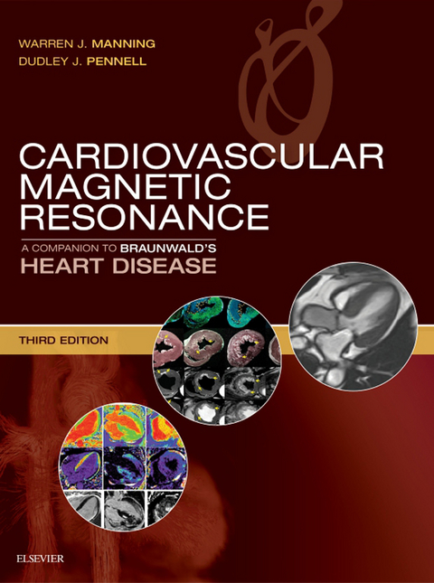 Cardiovascular Magnetic Resonance -  Warren J. Manning,  Dudley J. Pennell