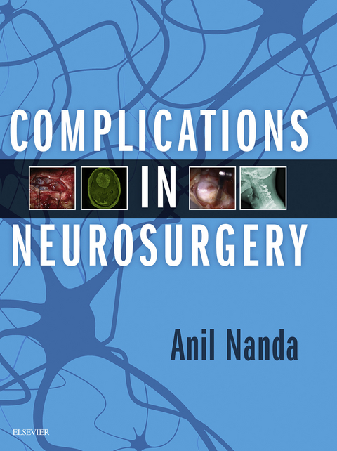 Complications in Neurosurgery E-Book -  Anil Nanda