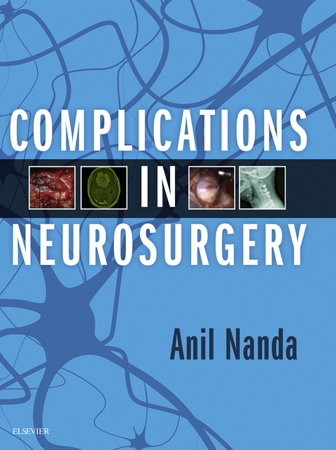 Complications in Neurosurgery E-Book - 