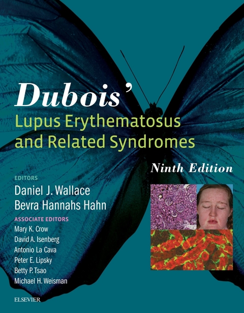 Dubois' Lupus Erythematosus and Related Syndromes -  Bevra Hahn,  Daniel J. Wallace
