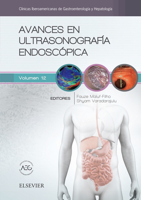 Avances en ultrasonografía endoscópica - 