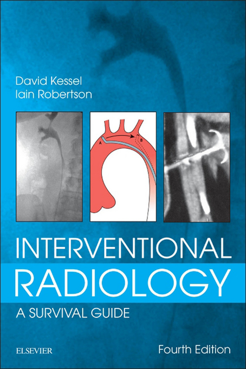 Interventional Radiology: A Survival Guide -  David Kessel,  Iain Robertson