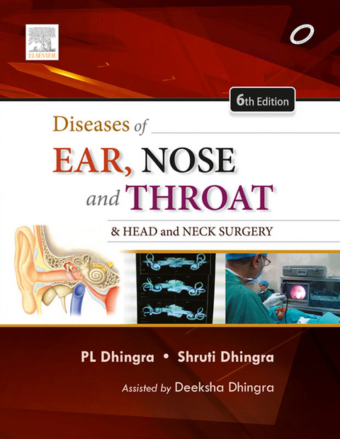 Diseases of Ear, Nose and Throat - E-Book -  P. L. Dhingra,  Shruti Dhingra