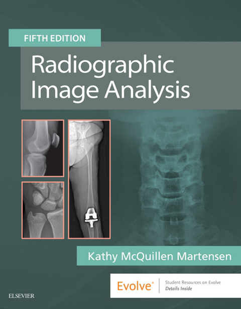 Radiographic Image Analysis E-Book -  Kathy McQuillen-Martensen