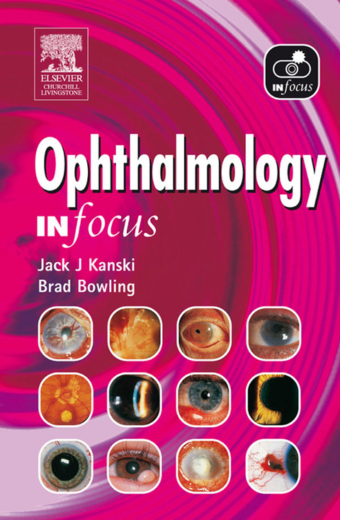 Ophthalmology In Focus -  Brad Bowling,  Jack J. Kanski