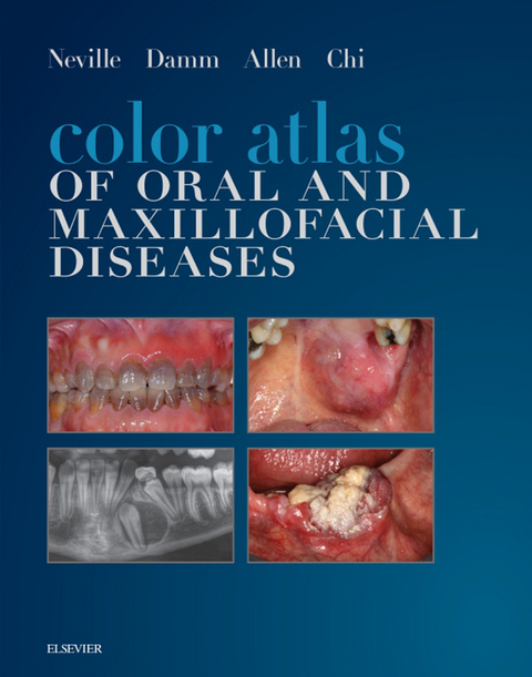 Color Atlas of Oral and Maxillofacial Diseases -  Carl M. Allen,  Angela C. Chi,  Douglas D. Damm,  Brad W. Neville
