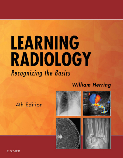 Learning Radiology E-Book -  William Herring