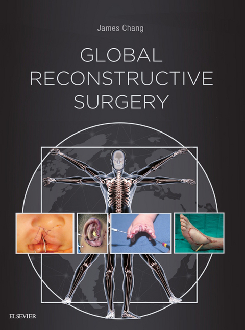 Global Reconstructive Surgery -  James Chang