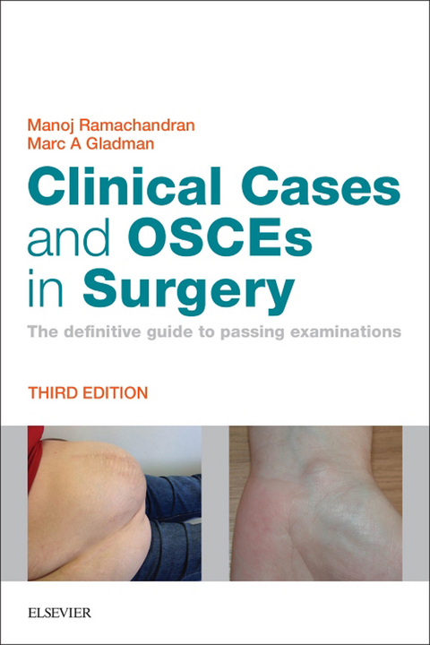 Clinical Cases and OSCEs in Surgery -  Marc A Gladman,  Manoj Ramachandran