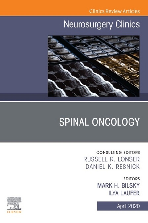 Spinal Oncology An Issue of Neurosurgery Clinics of North America - 