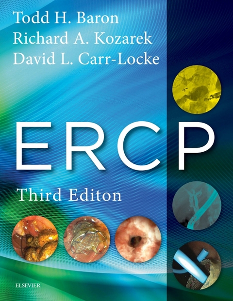 ERCP E-Book -  Todd H. Baron,  David Leslie Carr-Locke,  Richard A. Kozarek