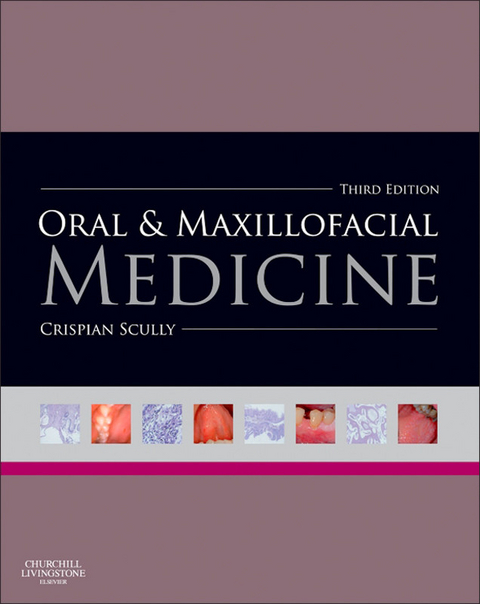 Oral and Maxillofacial Medicine - E-Book -  Crispian Scully