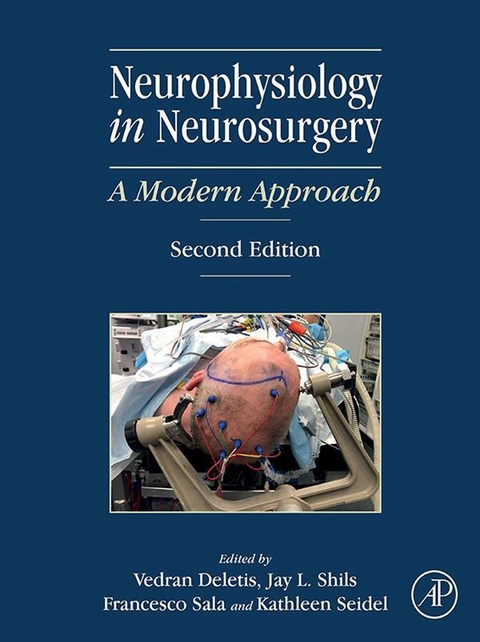 Neurophysiology in Neurosurgery - 
