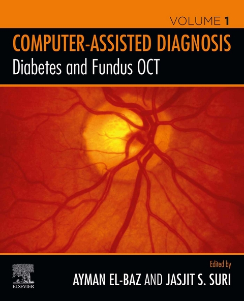 Diabetes and Fundus OCT - 