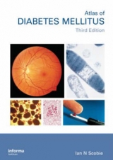 An Atlas of Diabetes Mellitus, Second Edition - Scobie, Ian N.