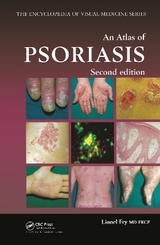 An Atlas of Psoriasis, Second Edition - Fry, Lionel
