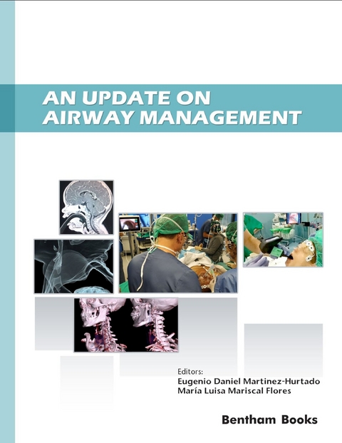 An Update on Airway Management - 