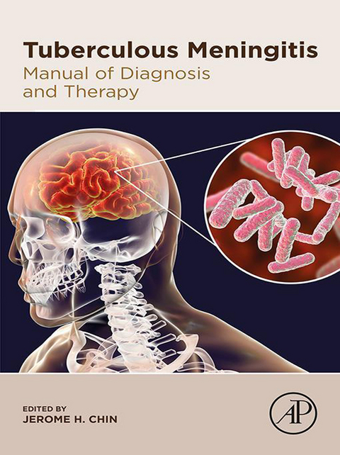 Tuberculous Meningitis - 