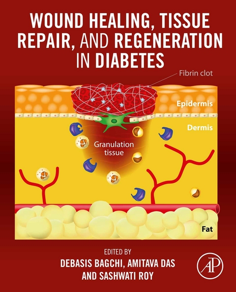 Wound Healing, Tissue Repair, and Regeneration in Diabetes - 