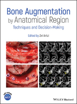 Bone Augmentation by Anatomical Region - 