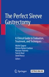 The Perfect Sleeve Gastrectomy - 