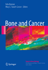 Bone and Cancer - 