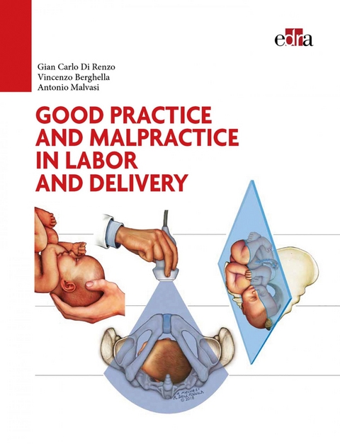 Good practice and malpractice in labor and delivery -  Gian Carlo Di Renzo