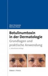 Botulinumtoxin in der Dermatologie - Heckmann, Marc; Rzany, Berthold