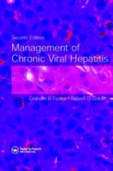 Management of Chronic Viral Hepatitis, Second Edition - Gordon, Stuart