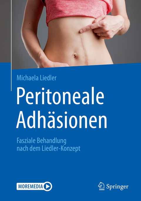 Peritoneale Adhäsionen - Michaela Liedler