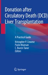 Donation after Circulatory Death (DCD) Liver Transplantation - 