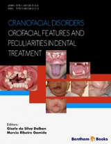 Craniofacial Disorders – Orofacial Features and Peculiarities in Dental Treatment - 