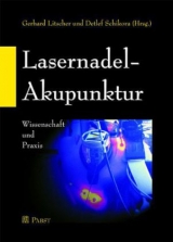 Lasernadel-Akupunktur - 
