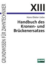 Handbuch des Kronen- und Brückenersatzes - Uebe, Hans D