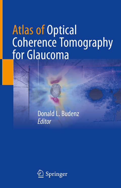 Atlas of Optical Coherence Tomography for Glaucoma - 