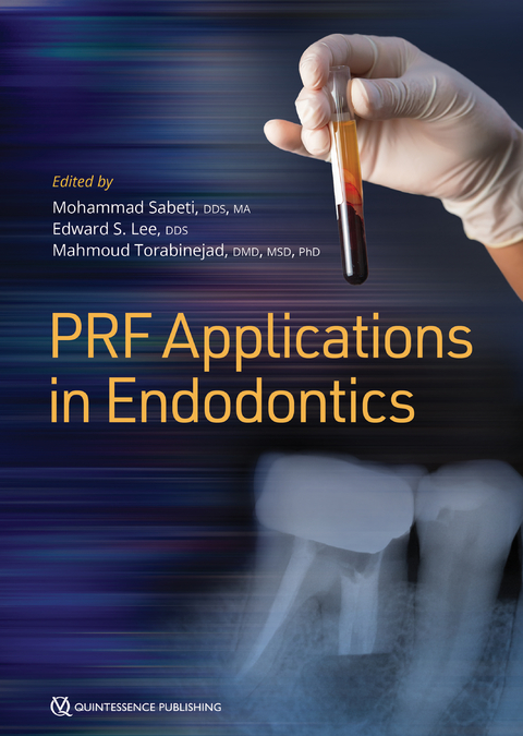 PRF Applications in Endodontics -  Edward S Lee,  Mohammad Sabeti,  Mahmoud Torabinejad