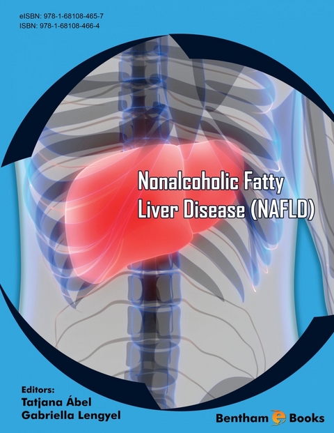 Nonalcoholic Fatty Liver Disease NAFLD - 