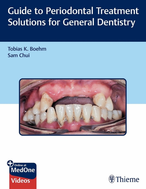 Guide to Periodontal Treatment Solutions for General Dentistry - Tobias K. Boehm, Sam Chui
