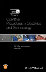 How to Perform Operative Procedures in Obstetrics and Gynaecology - 