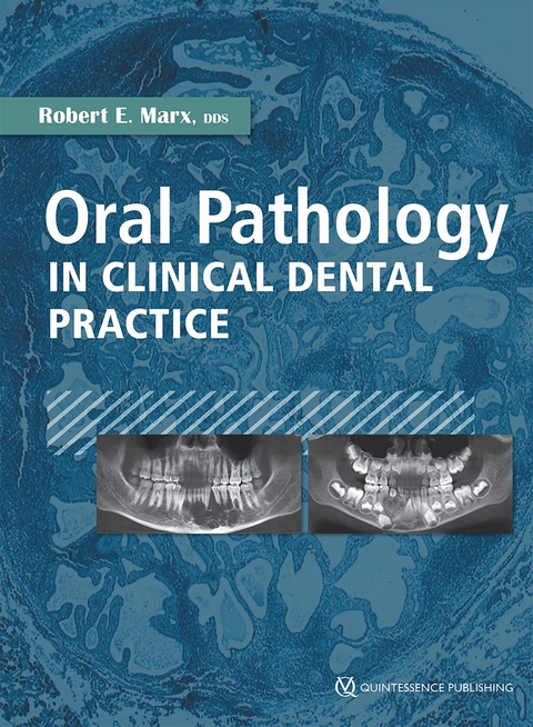 Oral Pathology in Clinical Dental Practice - Robert E. Marx