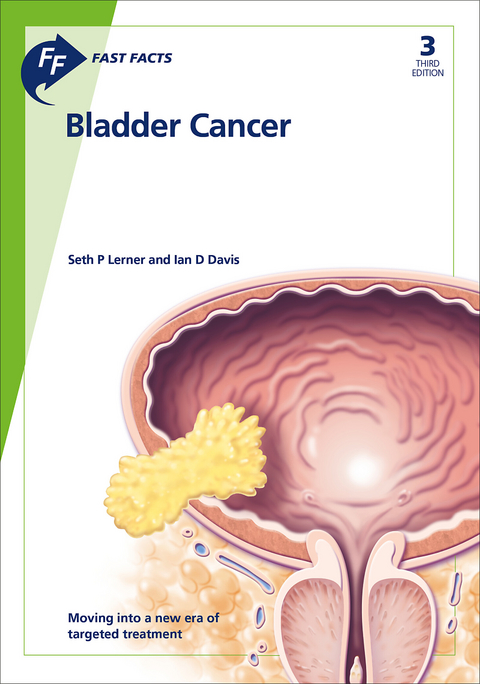 Fast Facts: Bladder Cancer - Seth P Lerner, Ian Davis